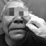 Niat Ingin Minum Teh, Geuchik Meunasah Drang Dihajar Sampai Masuk RS, Ketua APDESI Sesalkan Kejadian Tersebut