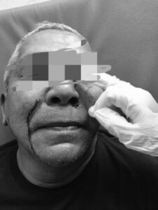 Niat Ingin Minum Teh, Geuchik Meunasah Drang Dihajar Sampai Masuk RS, Ketua APDESI Sesalkan Kejadian Tersebut